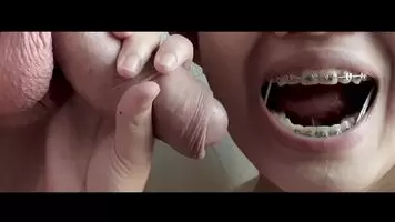Asian with braces elastics sucks white cock and foreskin