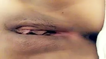 Counting birthmarks